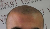 Vinci Hair Clinic 380136 Image 3
